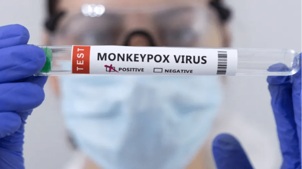 Trinidad and Tobago Records Two Cases of&nbsp;Mpox